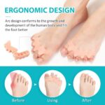 Correct Toes Spacers, Silicone Gel Toe Separators for Pedicure - Image 3