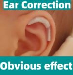 Ape Ear Corrector For Adults, Baby, Newborn and Infant