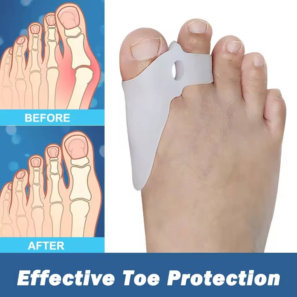 Gel Silicone Big Toe Dividers Spacer for Bunions 7