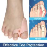 Gel Silicone Big Toe Separators for Overlapping Toes - Image 5