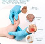 Silicone Toe Spreaders Dividers for Overlapping Toes - Image 6