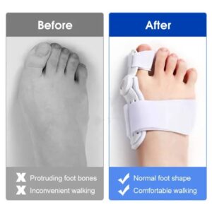 Toe Spacers for Bunions, Big Toe Stretcher 7