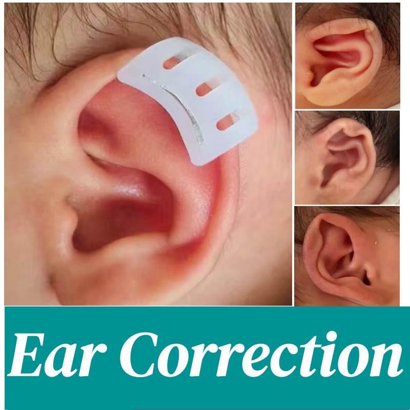 Infant-wearing-medical-grade-ear-corrector-for-babies-during-sleep