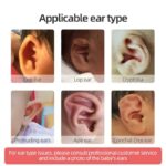 Prominent Ear Corrector Clip, Cup Ear Deformity Correction - Image 2