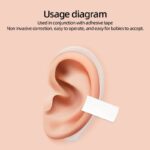 Prominent Ear Corrector Clip, Cup Ear Deformity Correction - Image 4