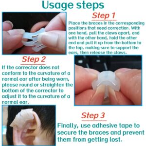 Lop Ear Deformity Correction Treatment For Baby & Adults 1