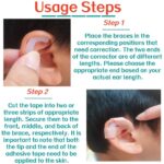 Stahl's Ear Correction Without Surgery