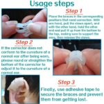 constricted ear deformity