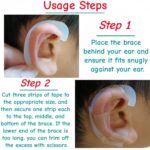 elf ear stickers for Veneer Ears 1