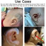 elf ear stickers for Veneer Ears