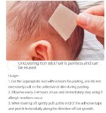 protruding ear correction without surgery 1